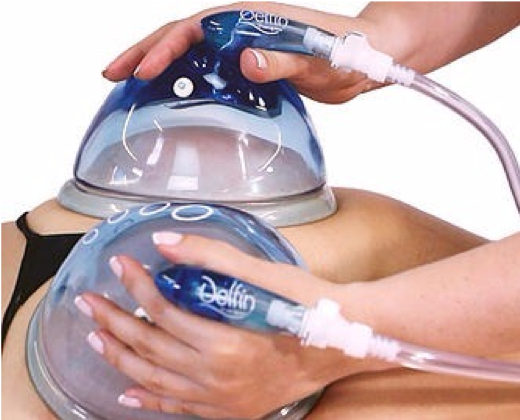 Vacumterapia Masajeador Para Levantar Gluteos Vacumterapia CorporaLab