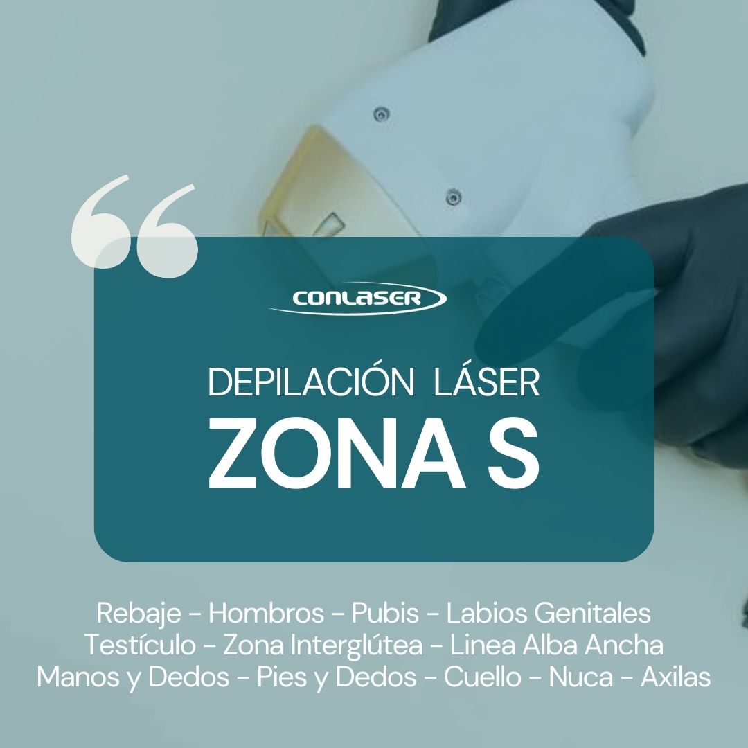 Depilación Láser - Zona S