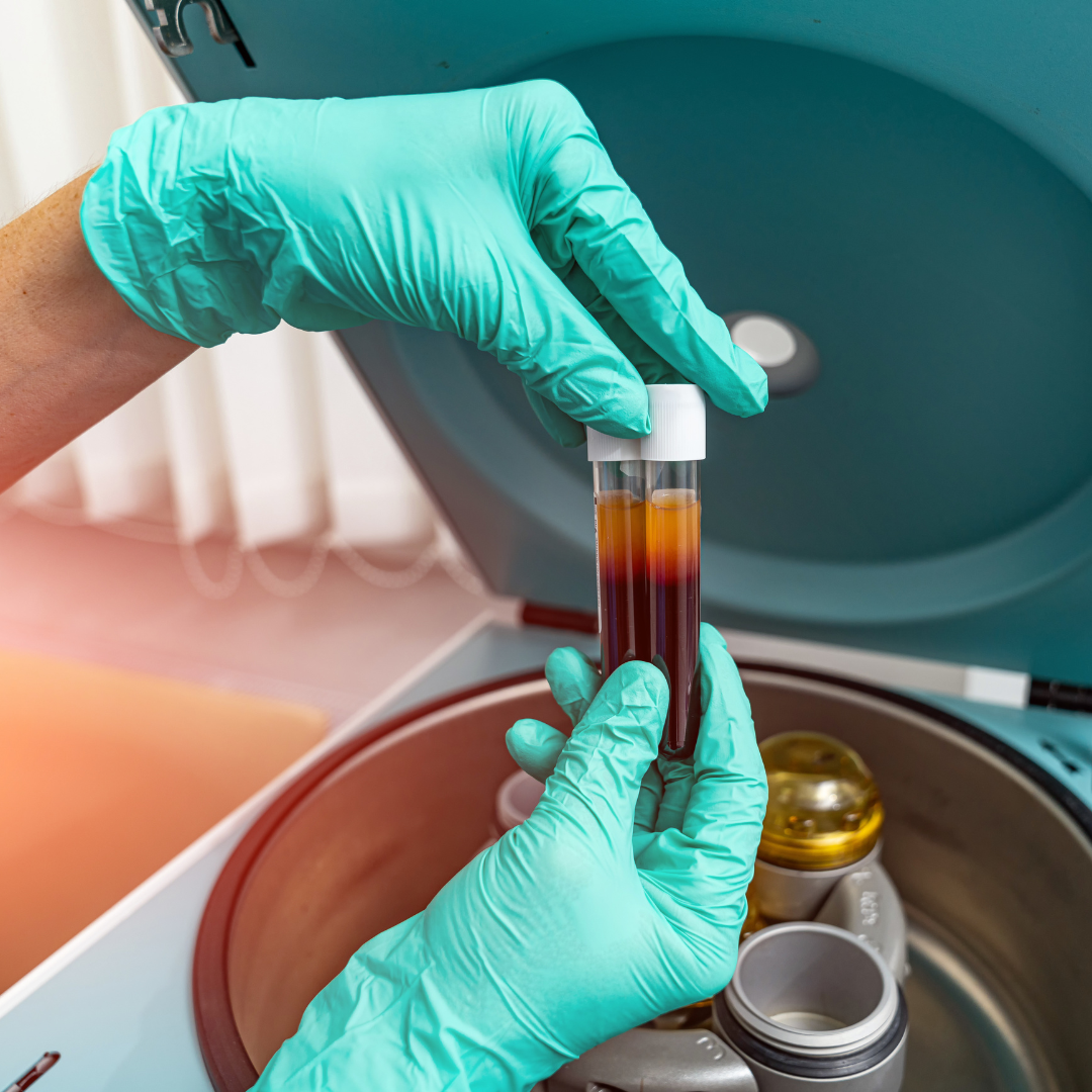 Plasma Rico en Plaquetas - Imagen 3